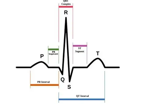 图一:心电图中的p-qrs-t波形图