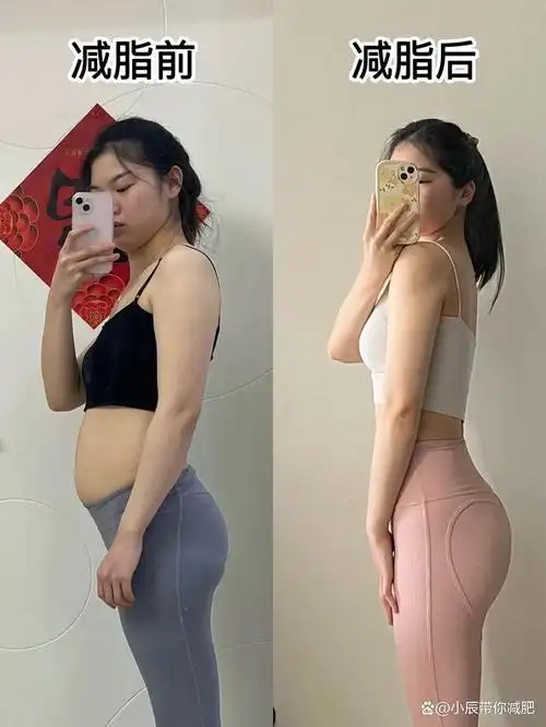 12,二女人怀孕时腹壁尤其是小腹被撑的很大,使得生育过的女人腹壁更加