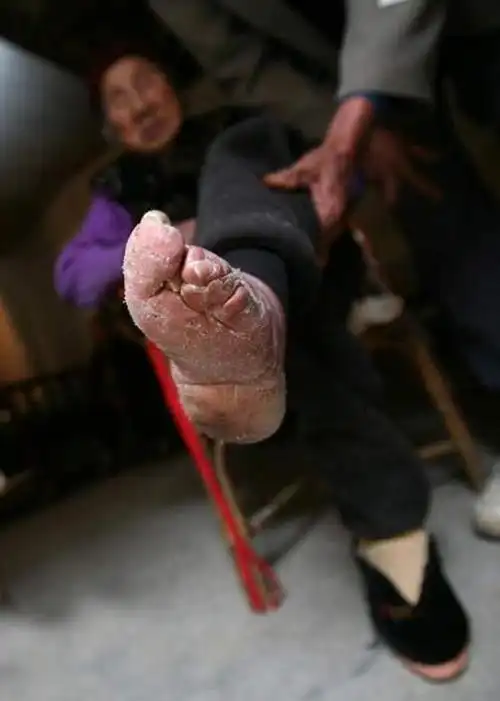 缠足——中国封建社会特有的习俗(组图)