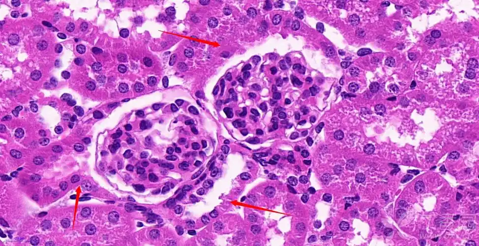 【求助】小鼠肾组织he染色,请教各位老师