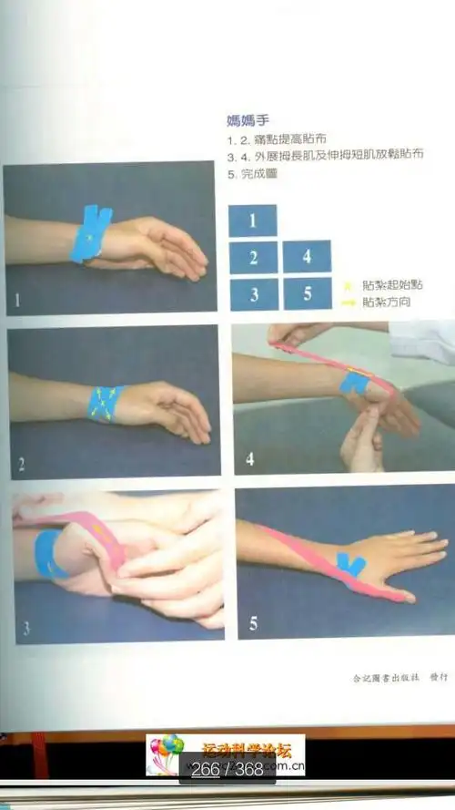 肌内效贴 妈妈手和肱二头肌肌腱炎的贴法