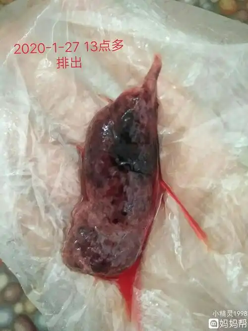 环保!备孕躺了2小时还是流出来了"深圳助孕"-第1张图片-霓裳博客