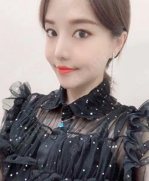 鼻子现在已经是很自然了,找不出手术的痕迹,主要恢复期也已经早过了