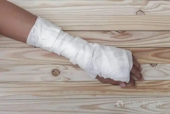 纱布绷带的手挫伤.治疗患者的手