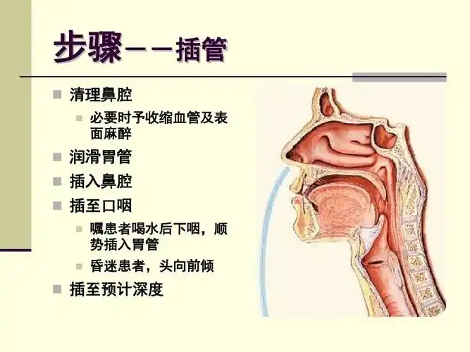 一例颅脑损伤患者胃管置入困难的案例分享