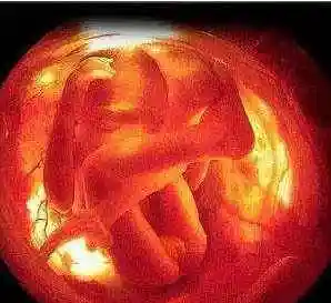 胎儿28周了 四维图一出 准妈懵了 医生再一问 一家人脸都绿了