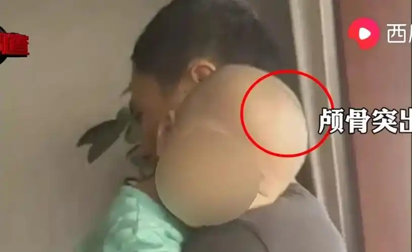 湖南郴州再现quot大头娃娃quotquot假奶粉quot背后的3条惊人启示