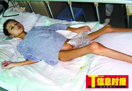 11岁男孩摔成植物人半年后已能做算术题图