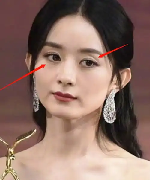 眼窝凹陷如何改善(怎么样改善眼窝凹陷)