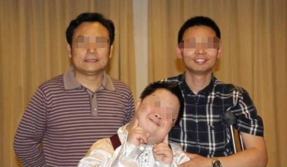 患有"唐氏综合征"的宝宝,面部特征很明显,婴儿阶段就能看出来