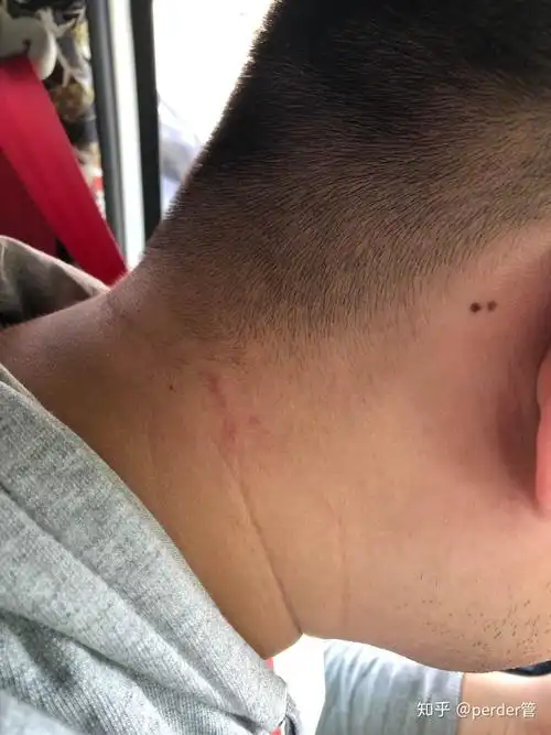 车里发现蜈蚣还咬了一口什么感觉 - 知乎