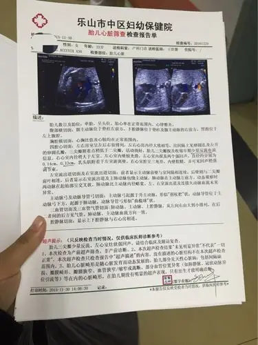 三尖瓣少量返流是什么意思?