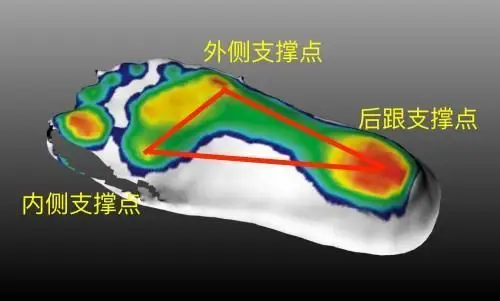 足底的受力点主要有三个,也是足弓形态的原理和稳定的基础.