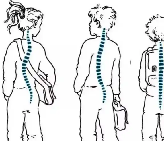 孩子总是弯腰驼背,该怎么办_姿势_情形_问题