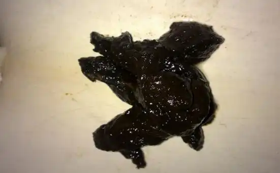 大便有一点黑色黏黏的东西,大便有一点点黑黑的