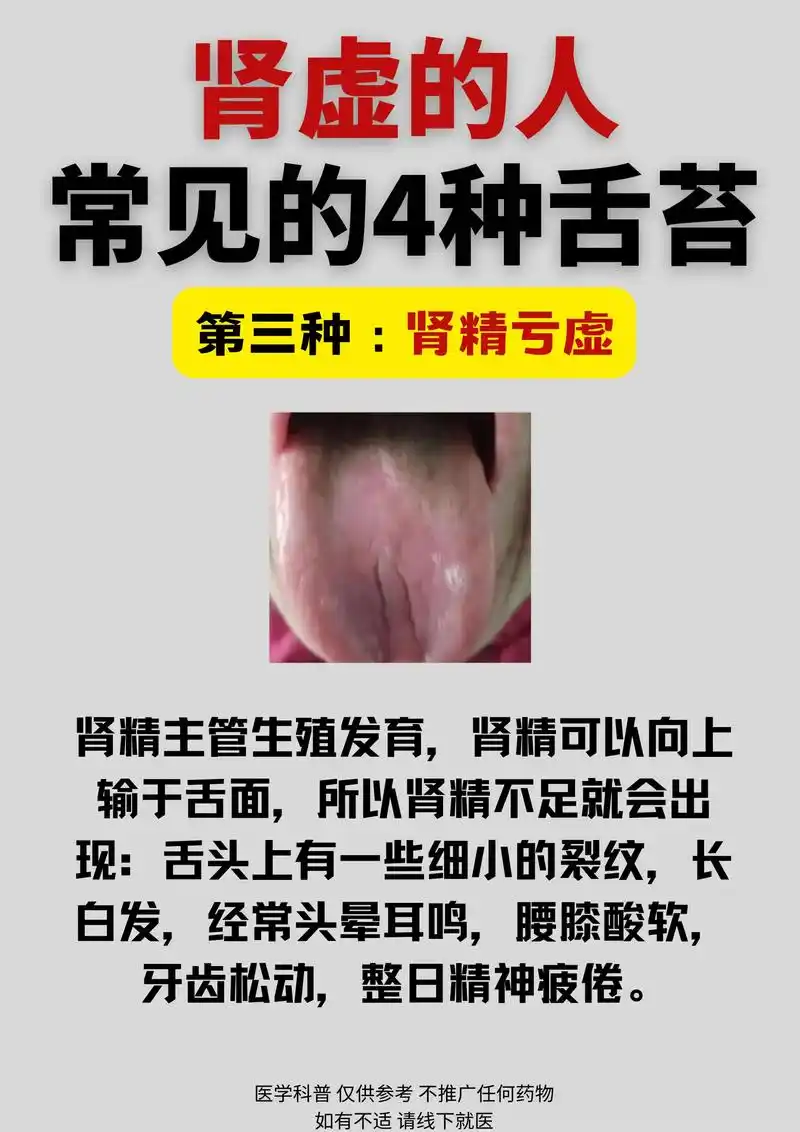 舌苔发白什么原因 - 抖音
