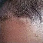 额头有旋代表什么,额头发旋算命