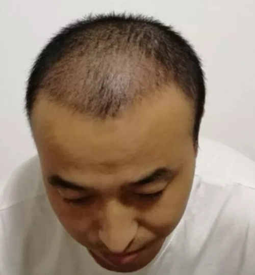 我希望头发看起来在蓬勃密度衔接得也很自然.