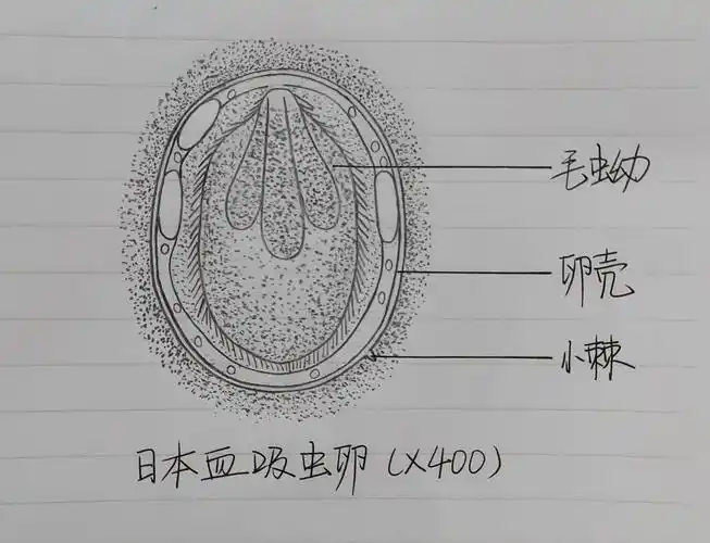 肺吸虫卵镜下图示:8.