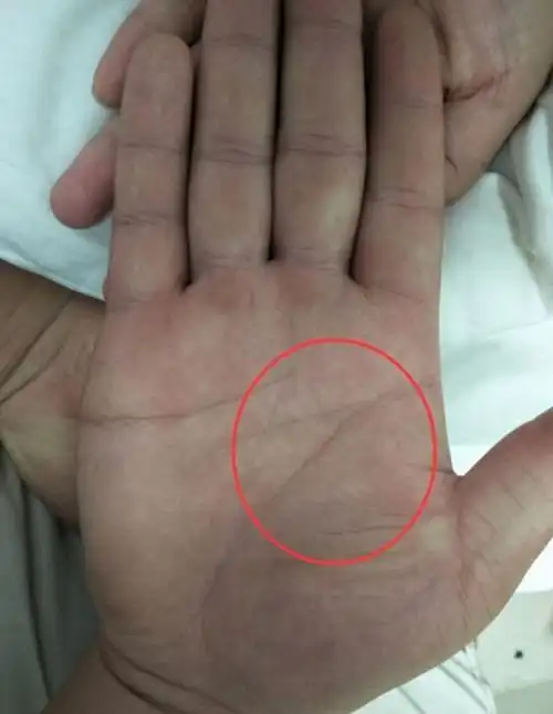 手纹算命图解子女线_手相手纹看子女情况_艺美轩