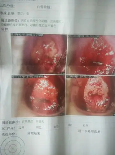 我和我老婆昨天晚上……的时候我把手指伸进去摸到一个有点硬又有点软