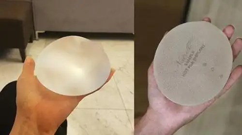 隆胸假体有哪些品牌?进口国产各品牌价格对比来了!