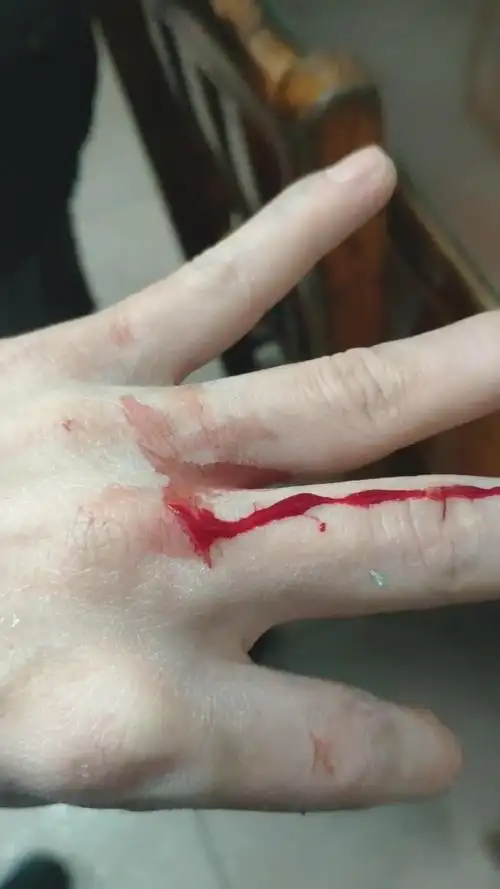 男人可以流血,但不能跪着活. 加油