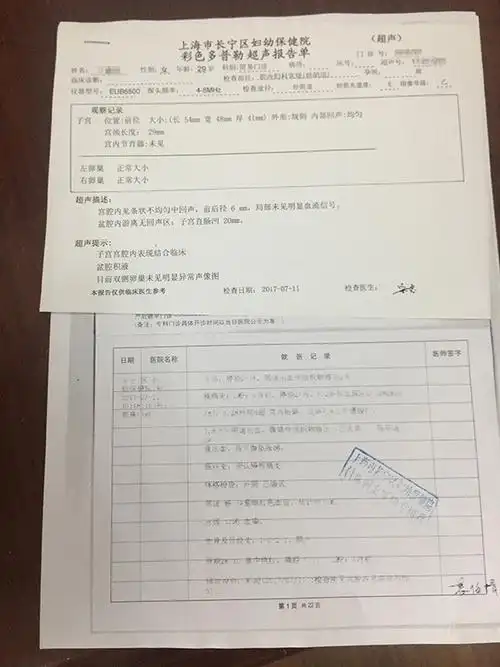 女子用ps伪造b超单谎称警方执法致其流产被刑拘