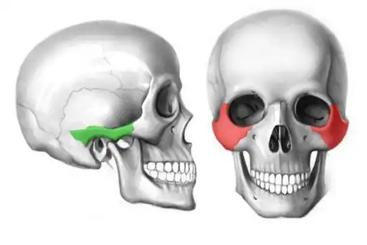 颧弓,颧骨位置图