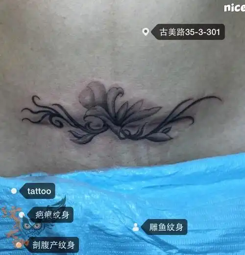 剖腹产纹身