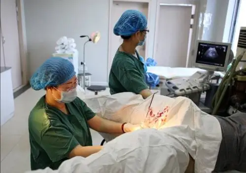 人流后需休息几天?