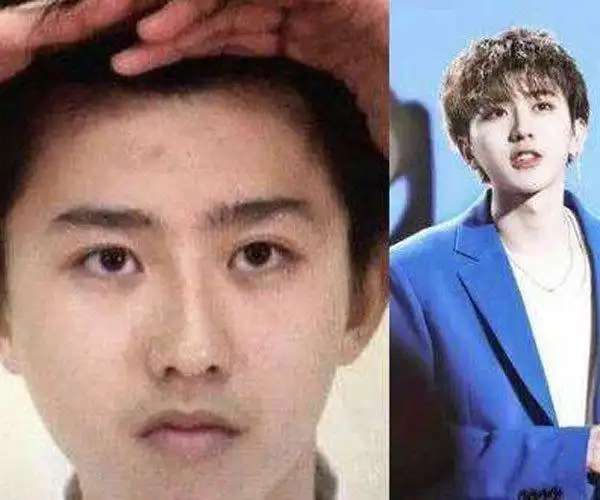 蔡徐坤素颜照片真丑图 知名度上升带来的争议不断