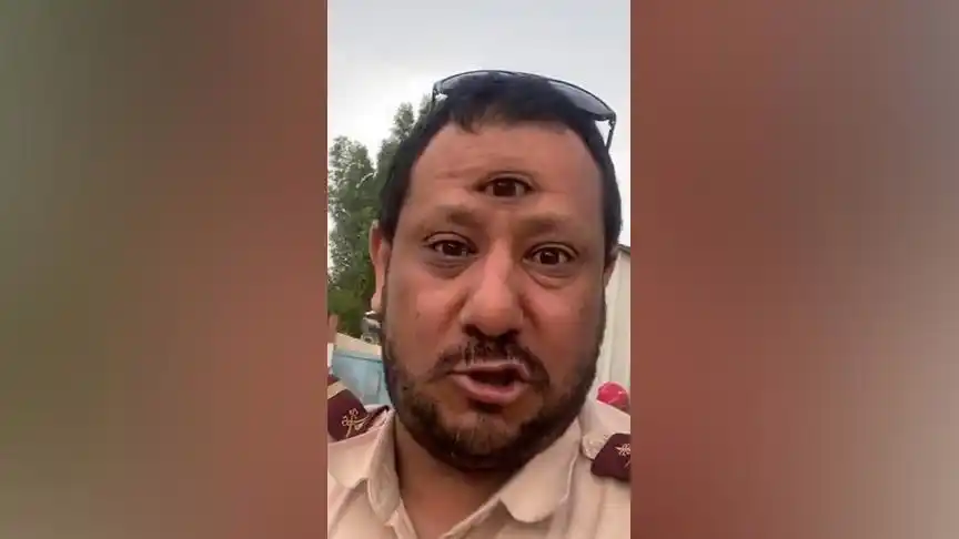 世界之大无奇不有,三只眼的奇人还真有0505见者点赞绝对发财