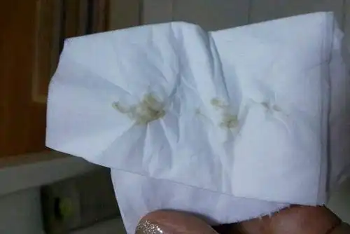 孕期的女性内裤经常潮潮的内裤有这种分泌物要重视起来