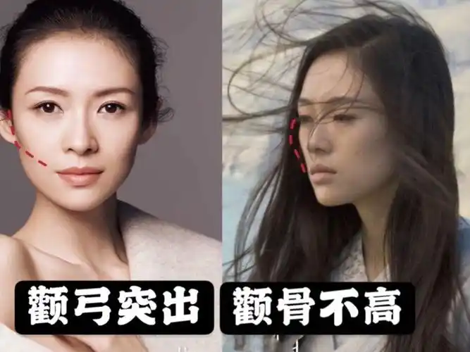 颧骨高的姐妹不要盲目想着去动骨头记得点关注哦
