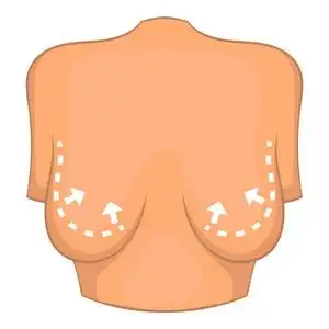 女性乳房发育过程图片