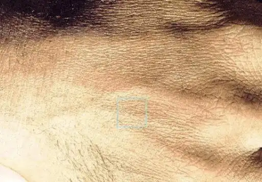 把人类的皮肤放大了亿万倍后, 呈现出来的样子, 超乎你的想象