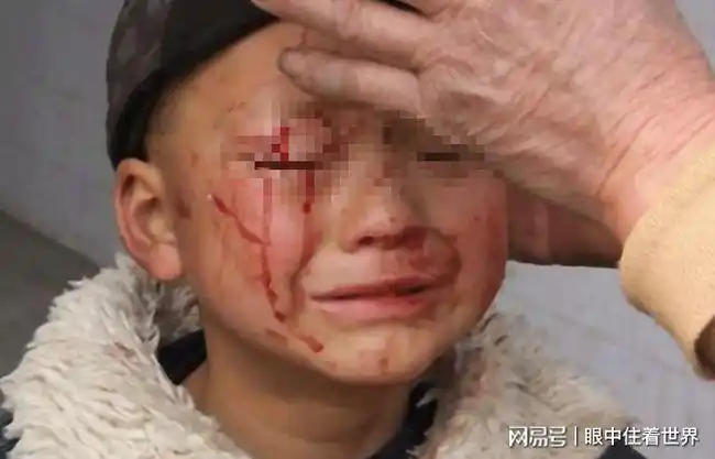 小孩被蝙蝠咬伤,父亲追蝙蝠到后山洞内,次日喊全村人将洞口封死