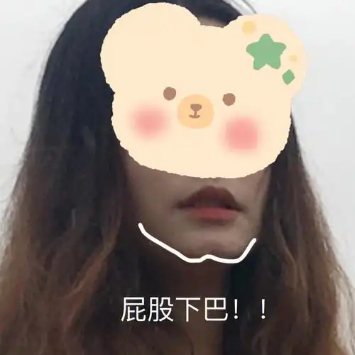屁股下巴的我打完玻尿酸后悔了