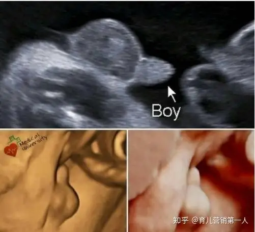 鉴定胎儿性别大多数夫妻都想错了别再被误导了