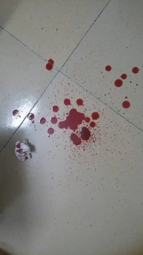 流鼻血会不会跟五脏有关系,隔一天就流!