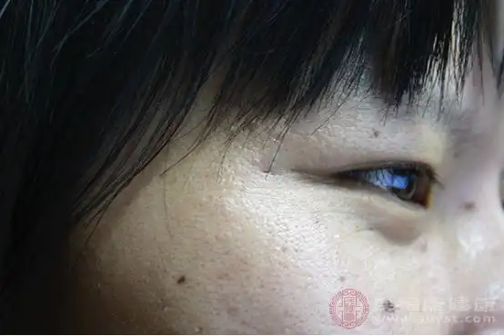 老年性白斑和老年性白癜风的区分