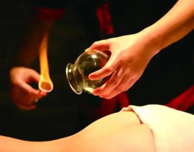 女人背部拔罐的好处和坏处,女人背部拔罐的好处和坏处图片