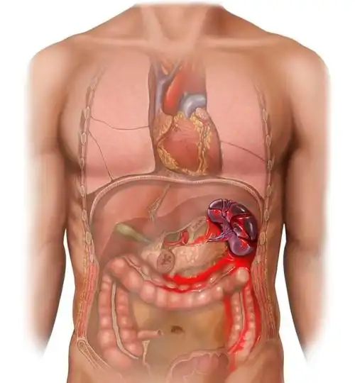 和其余四个"兄弟"相比,脾脏是个存在感很低的家伙,你知道脾脏有什么