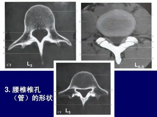 【影像诊断】脊柱区腰段断层解剖ppt