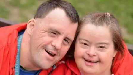 为什么唐氏综合症患者长相都差不多? 这些我们都不知道