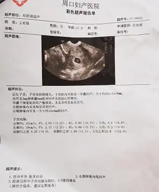 宫腔镜下双侧输卵管导丝疏通术为他们对症治疗张俊丽院长根据李女士