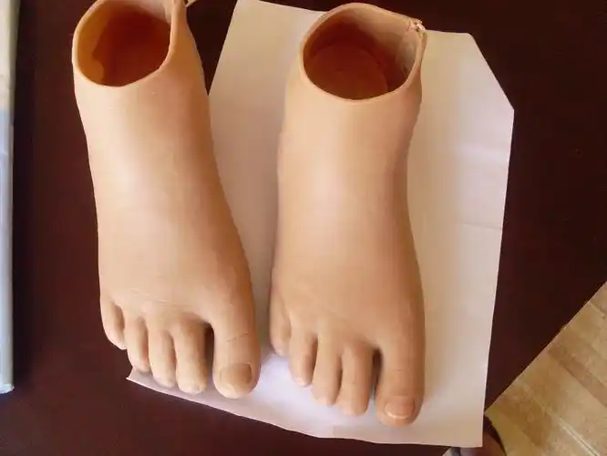 半足假肢-郑州市力康假肢矫形器有限公司