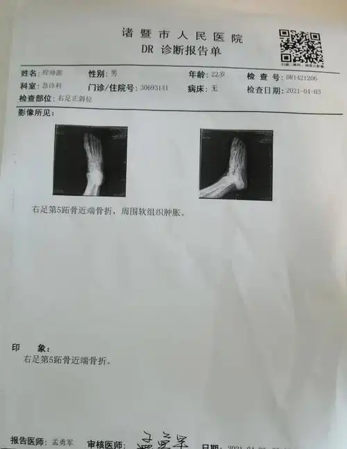 右足第5跖骨近端骨折,预计伤停三个月,#程帅澎赛...|程帅澎|懂球帝