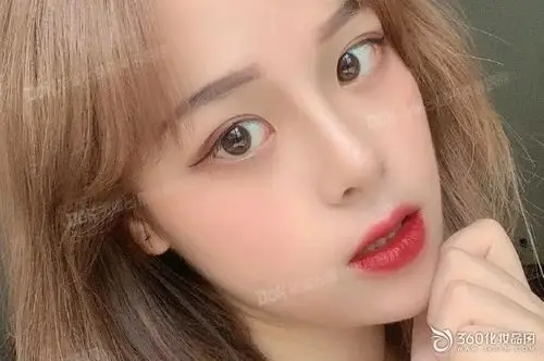 云南铜雀台整形真鼻子全城案例招募赵兰明真鼻子03汇集多年东方美鼻